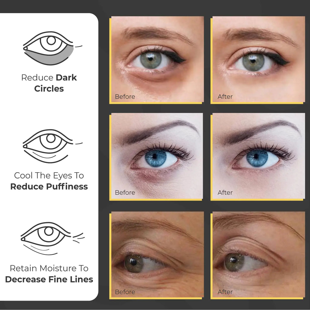 Under Eye Patches for Puffy Eyes and Dark Circles (60 Pairs) | Infused Gel Eye Mask Patches for Dark Circle Under Eye Support of Eye Bags & Puffiness | Ideal for Bridesmaids Gifts & Bachelorette Party Pi-Mart