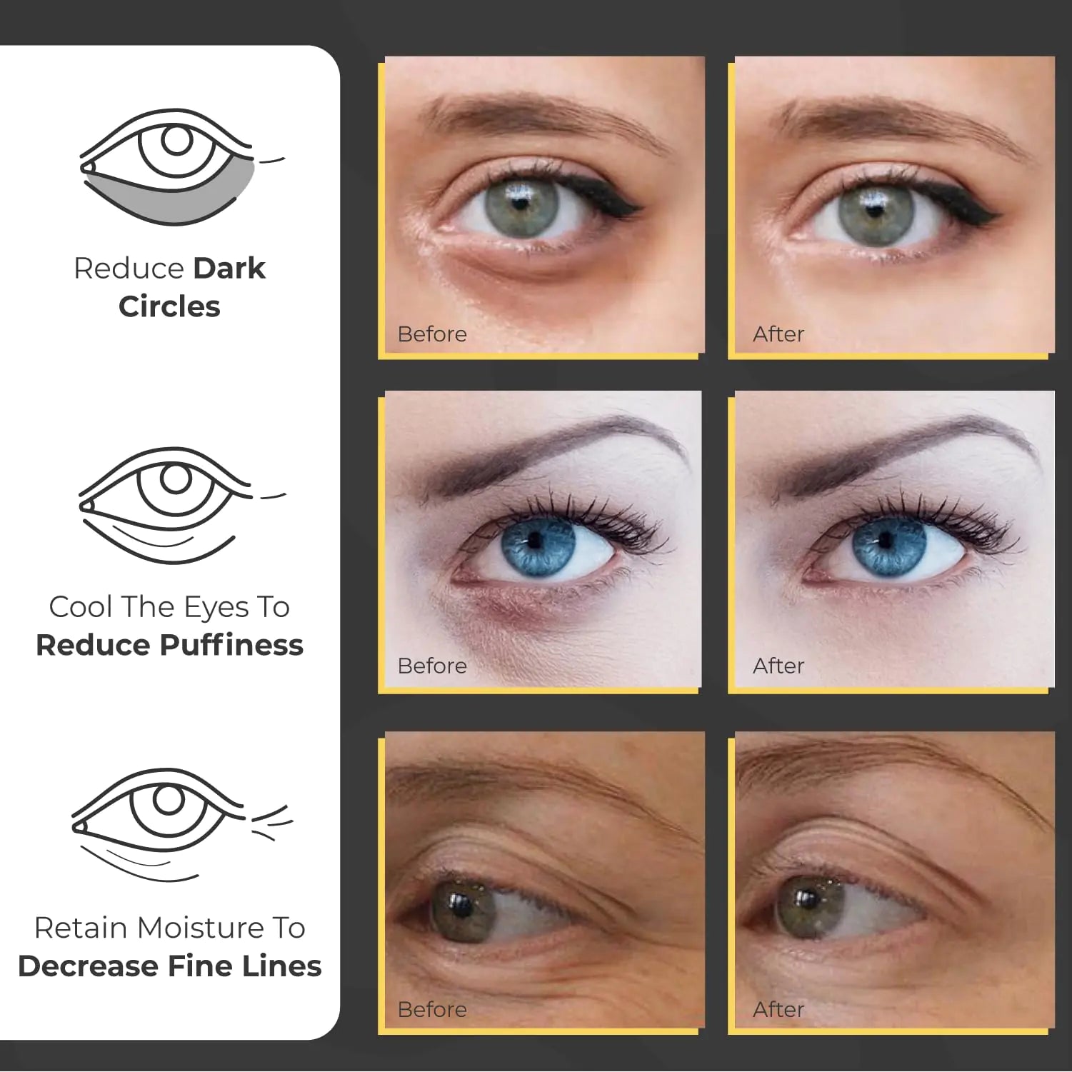 Under Eye Patches for Puffy Eyes and Dark Circles (60 Pairs) | Infused Gel Eye Mask Patches for Dark Circle Under Eye Support of Eye Bags & Puffiness | Ideal for Bridesmaids Gifts & Bachelorette Party Pi-Mart