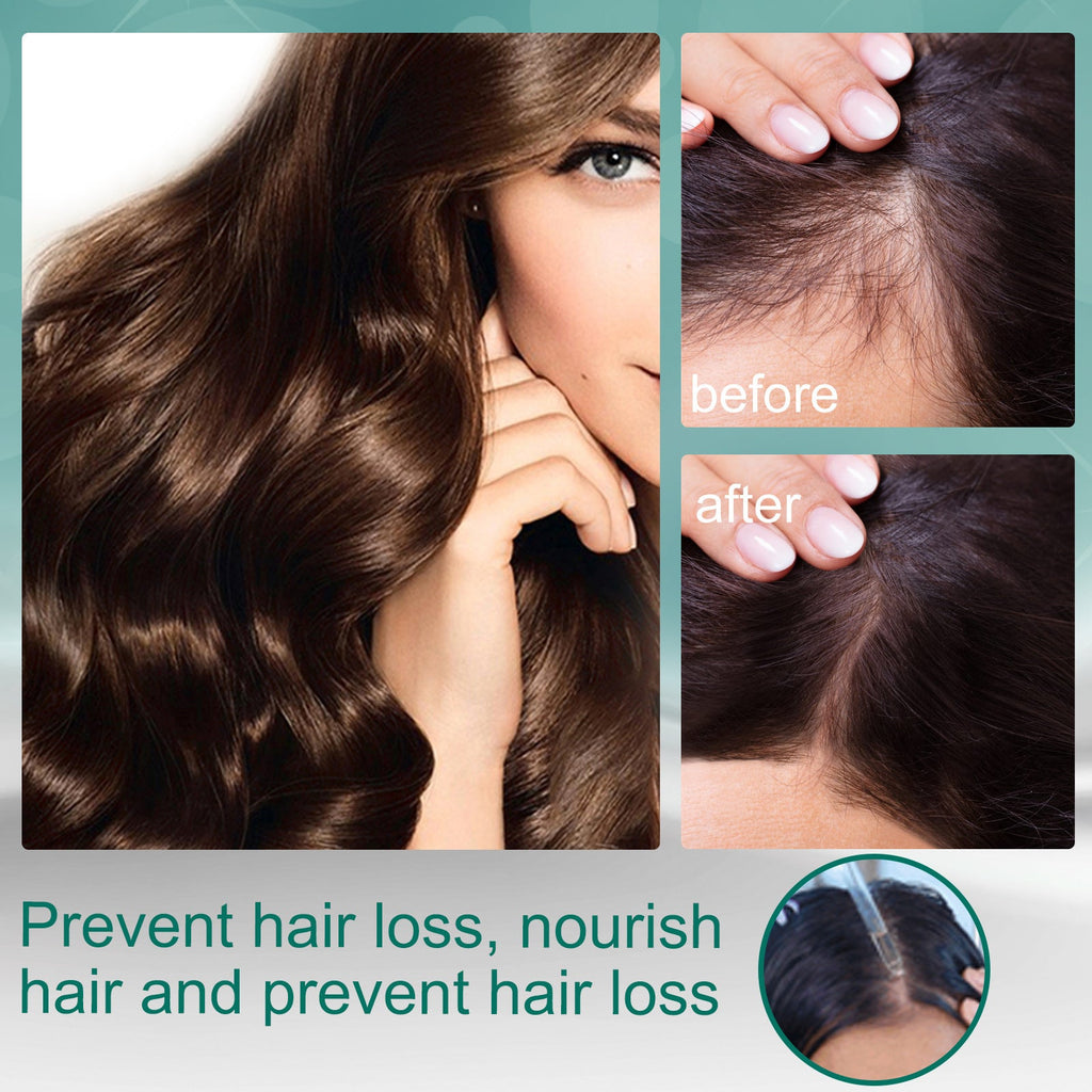 EELHOE Mature Ginger Up Hair Care Essential Oil Pi-Mart