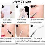 Acne Removal Tools Pimple Blackhead Remover Facial Pore Cleaner Stainless Steel with case - Skin Care tools