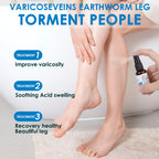 30ml Varicose Vein Spray Multi-Purpose Knee And Leg Care Spray Promote Blood Circulation Lootquake LLC