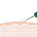 Ultrasonic Skin Rejuvenation Whitening Shoveling Machine Exfoliating Skin Care Lootquake LLC