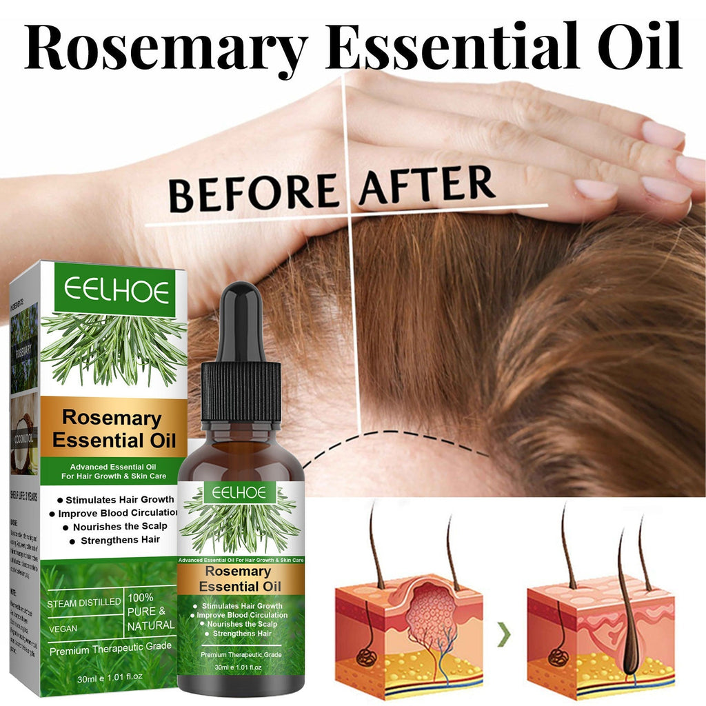 Rosemary Anti-Breakage Nourishing Hair Care Oil Lootquake LLC