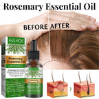 Rosemary Anti-Breakage Nourishing Hair Care Oil Lootquake LLC