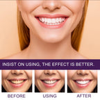 Toothpaste Tooth Stain Removal Cleaning Whitening Anti Pigment Precipitation