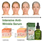 Deep Anti-wrinkle Tightens And Lightens The Face Pi-Mart