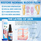 30ml Varicose Vein Spray Multi-Purpose Knee And Leg Care Spray Promote Blood Circulation Lootquake LLC