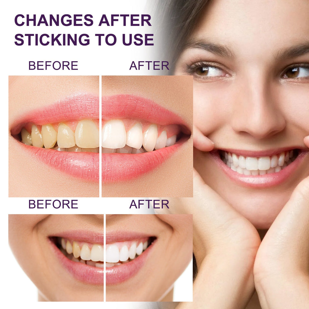 Toothpaste Tooth Stain Removal Cleaning Whitening Anti Pigment Precipitation