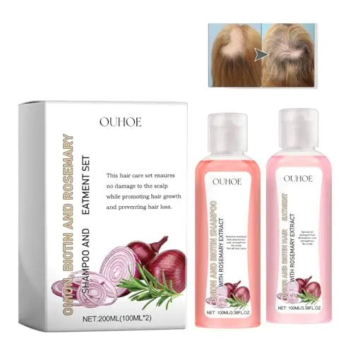 Onion Biotin and Rosemary Shampoo & Conditioner Hair Care Set for All Hair Types Lootquake LLC