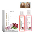 Onion Biotin and Rosemary Shampoo & Conditioner Hair Care Set for All Hair Types Lootquake LLC