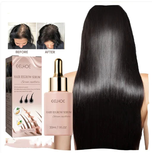 EELHOE Hair Dense Essence Hair Anti-hair Loss And Hair Fixation Nutrition Lootquake LLC