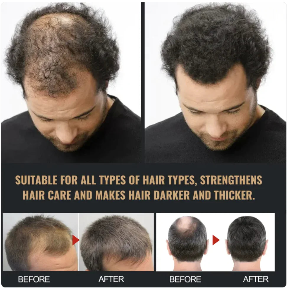 Thick & Fluffy Anti-Hair Loss Repair Shampoo Pi-Mart
